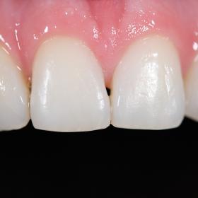 Blog Krzysztofa Bączkowskiego